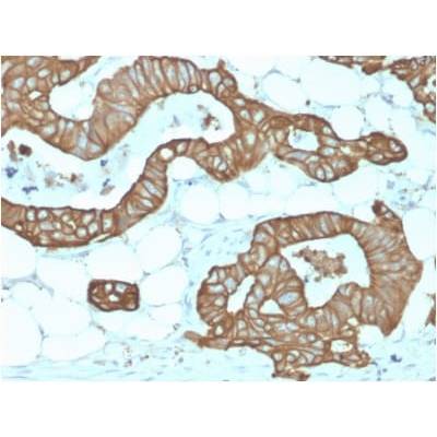 Cytokeratin 19 (KRT19) (Pancreatic Stem Cell Marker) (KRT19/1959R), Biotin conjugate, 0.1mg/mL