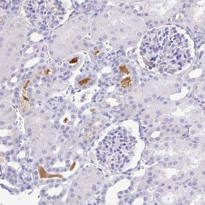 Anti-A1BG Antibody