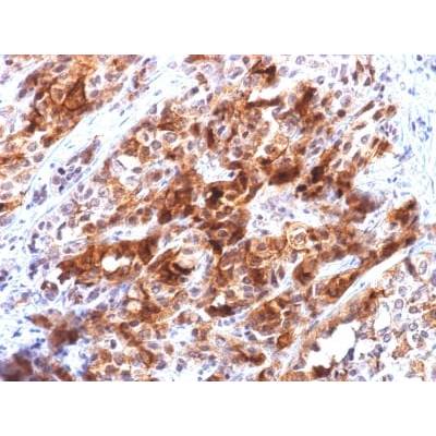 Glypican-3 (GPC3) (Hepatocellular Carcinoma Marker) (rGPC3/863), CF405S conjugate, 0.1mg/mL