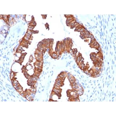 Cytokeratin 7 (Glandular and Transitional Epithelial Marker) (rOV-TL12/30), CF405S conjugate, 0.1mg/mL
