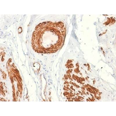 Caldesmon, HMW (h-Caldesmon) (Smooth Muscle Marker) (rCALD1/820), CF488A conjugate, 0.1mg/mL