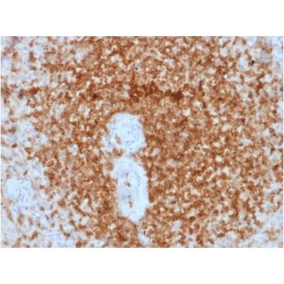 Bcl-2 (Apoptosis & Follicular Lymphoma Marker) (rBCL2/796), Biotin conjugate, 0.1mg/mL