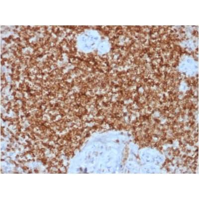 Bcl-2 (Apoptosis & Follicular Lymphoma Marker) (BCL2/1878R), CF405S conjugate, 0.1mg/mL
