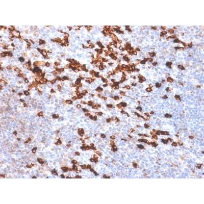 Kappa Light Chain (B-Cell Marker) (IGKC/1999R), Biotin conjugate, 0.1mg/mL