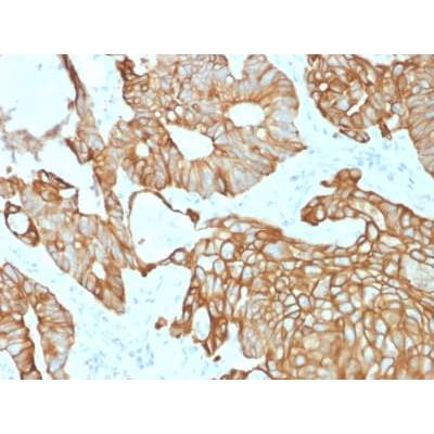 Cytokeratin 19 (Pancreatic Stem Cell Marker) (rKRT19/800), CF405S conjugate, 0.1mg/mL