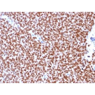 NKX2.2 (Neuroendocrine &amp; Ewing s Sarcoma Marker) (rNX2/294), Biotin conjugate, 0.1mg/mL