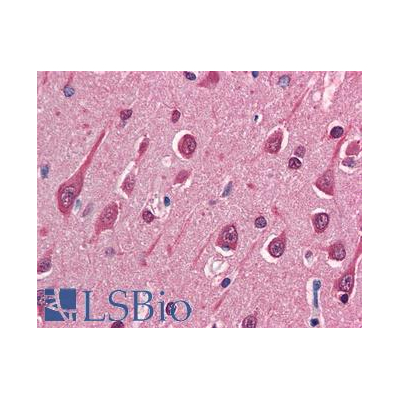 Mouse Anti-MAP1B Antibody (Azide-free) IHC-plus™