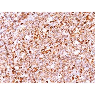 CD79a (IGA/1688R), CF488A conjugate, 0.1mg/mL