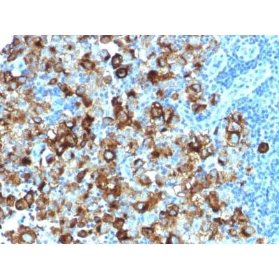 gp100 / Melanosome / PMEL17 / SILV (Melanoma Marker) (PMEL/1825R), CF488A conjugate, 0.1mg/mL
