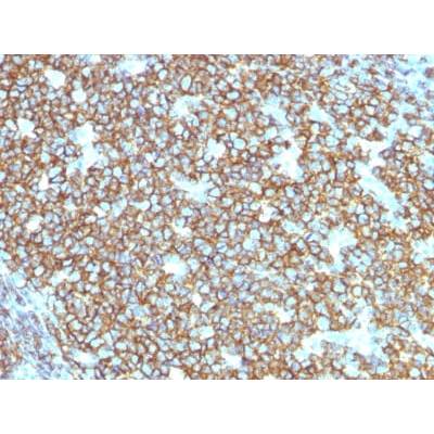 CD20 / MS4A1 (B-Cell Marker) (rIGEL/773), CF488A conjugate, 0.1mg/mL