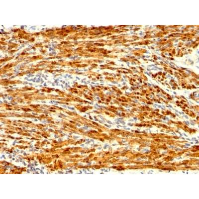 Calponin-1 (Smooth Muscle Marker) (CNN1/1408R), CF568 conjugate, 0.1mg/mL