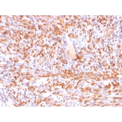 Calponin-1 (Smooth Muscle Marker) (rCNN1/832), CF405S conjugate, 0.1mg/mL
