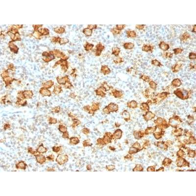 CD30 / TNFRSF8 (Hodgkin &amp; Reed-Sternberg Cell Marker) (Ki-1/1505R), CF405S conjugate, 0.1mg/mL