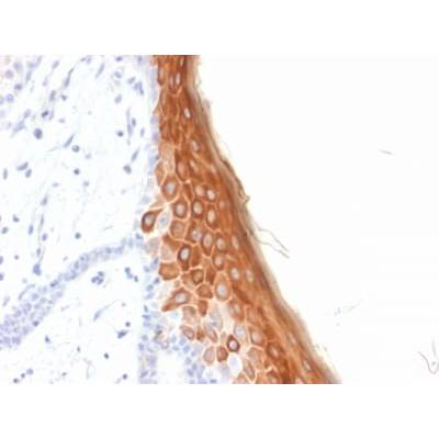 Cytokeratin 10 (KRT10) (Suprabasal Epithelial Marker) (rKRT10/844), CF488A conjugate, 0.1mg/mL