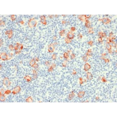 CD30 / TNFRSF8 (Hodgkin & Reed-Sternberg Cell Marker) (rCD30/412), CF488A conjugate, 0.1mg/mL