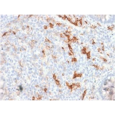 NGF-Receptor (p75) / CD271 (Soft Tissue Tumor Marker) (NGFR/1997R), Biotin conjugate, 0.1mg/mL