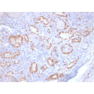 TTF-1 / NKX2.1 (Thyroid & Lung Epithelial Marker) (rNX2.1/690), CF405S conjugate, 0.1mg/mL