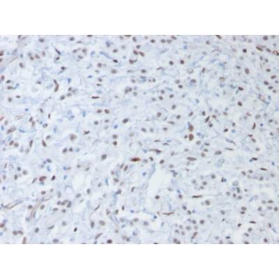 Wilm s Tumor 1 (WT1) (Wilm s Tumor &amp; Mesothelial Marker) (rWT1/857), CF405S conjugate, 0.1mg/mL