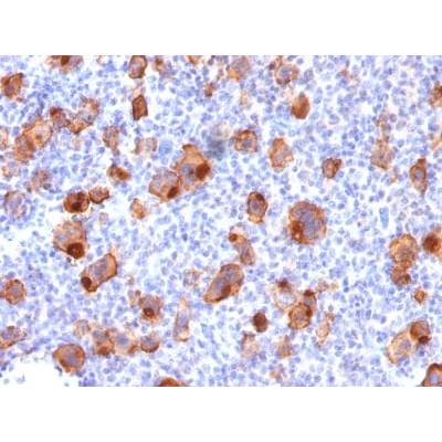 CD30 / TNFRSF8 (Hodgkin &amp; Reed-Sternberg Cell Marker) (rKi-1/779), CF405S conjugate, 0.1mg/mL