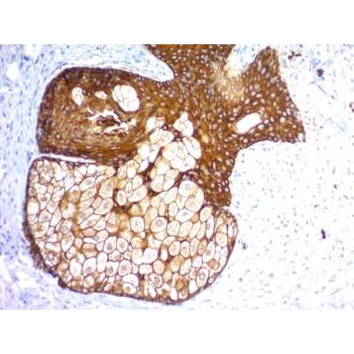 Cytokeratin, pan (Epithelial Marker) (KRTH/1576R + KRTL/1577R), CF488A conjugate, 0.1mg/mL