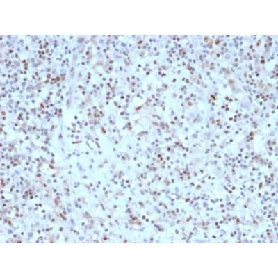 Bcl-6 (Follicular Lymphoma Marker) (rBCL6/1527), Biotin conjugate, 0.1mg/mL