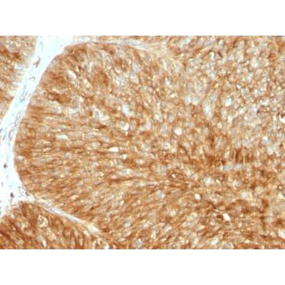 Beta-2 Microglobulin (Renal Failure & Tumor Marker) (B2M/1857R), CF405S conjugate, 0.1mg/mL