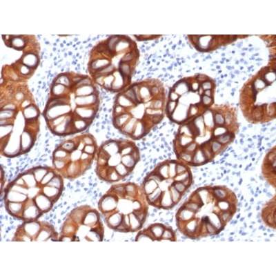 Ep-CAM / CD326 (Epithelial Marker) (rMOC-31), CF488A conjugate, 0.1mg/mL
