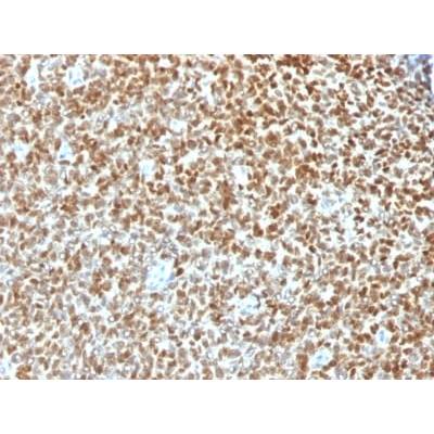 NKX2.2 (Neuroendocrine &amp; Ewing s Sarcoma Marker) (NX2/1422R), CF568 conjugate, 0.1mg/mL