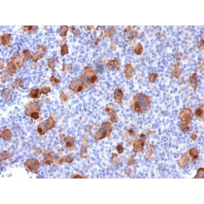 CD30 / TNFRSF8 (Hodgkin &amp; Reed-Sternberg Cell Marker) (Ki-1/1747R), CF488A conjugate, 0.1mg/mL