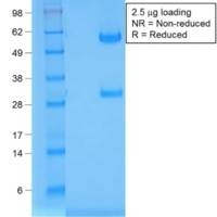 TTF-1 / NKX2.1 (Thyroid & Lung Epithelial Marker) (rNX2.1/690), CF488A conjugate, 0.1mg/mL