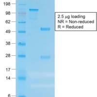 Carcinoembryonic Antigen (CEA) / CD66 (C66/1983R), CF488A conjugate, 0.1mg/mL