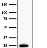 Bcl-2 (Apoptosis & Follicular Lymphoma Marker) (BCL2/1878R), Biotin conjugate, 0.1mg/mL