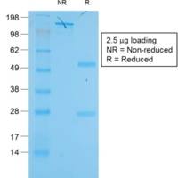 Cytokeratin 19 (KRT19) (Pancreatic Stem Cell Marker) (KRT19/1959R), Biotin conjugate, 0.1mg/mL