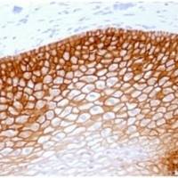 CD44v4 (Marker of Tumor Metastasis) (rCD44v4/1219), Biotin conjugate, 0.1mg/mL