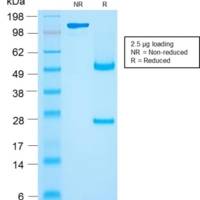 CD27 (Tumor Necrosis Factor Receptor Superfamily 7) (rLPFS2/1611), Biotin conjugate, 0.1mg/mL