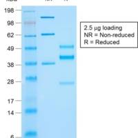 Cytokeratin 10 (KRT10) (Suprabasal Epithelial Marker) (rKRT10/844), CF405S conjugate, 0.1mg/mL