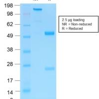NGF-Receptor (p75) / CD271 (Soft Tissue Tumor Marker) (NGFR/1997R), Biotin conjugate, 0.1mg/mL