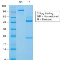 Filaggrin (Keratinocyte Differentiation Marker) (FLG/1957R), CF488A conjugate, 0.1mg/mL