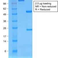 Beta-2 Microglobulin (Renal Failure &Tumor Marker) (rB2M/961), CF405S conjugate, 0.1mg/mL