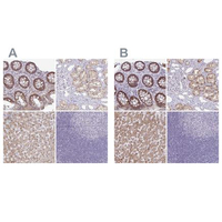 Anti-A1CF Antibody