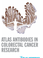Anti-A1CF Antibody