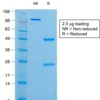 Thyroglobulin (Thyroidal Cell Marker) (r6E1), Biotin conjugate, 0.1mg/mL