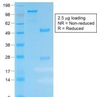 Kappa Light Chain (B-Cell Marker) (IGKC/1999R), Biotin conjugate, 0.1mg/mL
