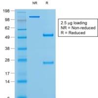 Bcl-6 (Follicular Lymphoma Marker) (rBCL6/1527), CF405S conjugate, 0.1mg/mL