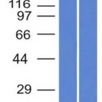 von Willebrand Factor / Factor VIII Related-Ag (Endothelial Marker) (VWF/1859R), CF405S conjugate, 0.1mg/mL