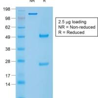 Caldesmon, HMW (h-Caldesmon) (Smooth Muscle Marker) (rCALD1/820), CF488A conjugate, 0.1mg/mL