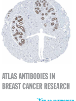 Anti-A1CF Antibody