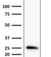 Bcl-2 (Apoptosis & Follicular Lymphoma Marker) (rBCL2/796), CF405S conjugate, 0.1mg/mL