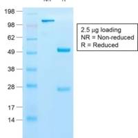 Cytokeratin 10 (KRT10) (Suprabasal Epithelial Marker) (KRT10/1990R), CF405S conjugate, 0.1mg/mL