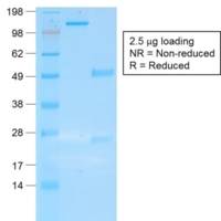 Cytokeratin 19 (Pancreatic Stem Cell Marker) (rKRT19/800), CF405S conjugate, 0.1mg/mL